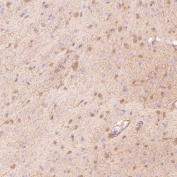 IHC staining of FFPE mouse hippocampus tissue with S100 beta antibody. HIER: boil tissue sections in pH6, 10mM citrate buffer, for 10-20 min and allow to cool before testing.