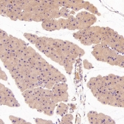IHC staining of FFPE mouse pancreas tissue with S100 beta antibody. HIER: boil tissue sections in pH6, 10mM citrate buffer, for 10-20 min and allow to cool before testing.