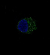 Immunofluorescent staining of human A375 cells with S100 beta antibody (green) and DAPI nuclear stain (blue). HIER: steam section in pH6 citrate buffer for 20 min.