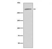 Western blot testing of human serum lysate with von Willebrand Factor antibody. Predicted molecular weight ~309 kDa.