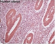 IHC staining of FFPE human uterus with GAPDH antibody. HIER: boil tissue sections in pH6, 10mM citrate buffer, for 10-20 min and allow to cool before testing.
