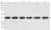 Western blot testing of 1) human HeLa, 2) human Jurkat, 3) mouse kidney, 4) mouse spleen, 5) mouse RAW264 and 6) rat brain lysate with GAPDH antibody. Predicted molecular weight ~36 kDa.