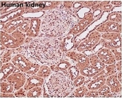 IHC staining of FFPE human kidney with GAPDH antibody. HIER: boil tissue sections in pH6, 10mM citrate buffer, for 10-20 min and allow to cool before testing.