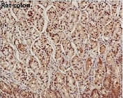 IHC staining of FFPE rat colon with GAPDH antibody. HIER: boil tissue sections in pH6, 10mM citrate buffer, for 10-20 min and allow to cool before testing.