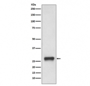 Western blot testing of human Daudi cell lysate with HLA-DPB1 antibody. Predicted molecular weight ~27 kDa.