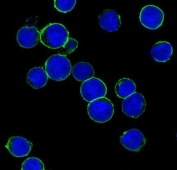 IF/ICC staining of human SK-BR-3 cells with HER2 antibody (green) and DAPI nuclear stain (blue).