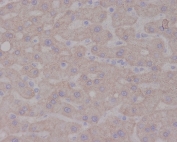 IHC staining of FFPE human liver tissue with NTRK1 antibody. HIER: boil tissue sections in pH6, 10mM citrate buffer, for 10-20 min and allow to cool before testing.