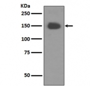 Western blot testing of human fetal brain lysate with NTRK1 antibody. Expected molecular weight: 85~140 kDa depending on glycosylation level.