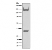 Western blot testing of human fetal brain lysate with TrkA/B/C antibody. Expected molecular weight: 85~140 kDa depending on glycosylation level.