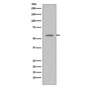 Western blot testing of lysate from human T-47D cells treated with etoposide, with phospho-p53 antibody (pS33). Predicted molecular weight ~53 kDa.