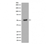 Western blot testing of lysate from human HEK293 cells treated with Calyculin A and okadaic acid, with phospho-p53 antibody (pT55). Predicted molecular weight ~53 kDa.