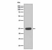 Western blot testing of human Jurkat cell lysate with Interferon gamma antibody. Expected molecular weight: 19-24 kDa depending on glycosylation level.