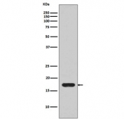 Western blot testing of recombinant human IL1 beta partial protein with IL1B antibody.
