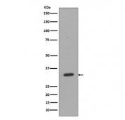 Western blot testing of human Jurkat cell lysate with CD8A antibody. Predicted molecular weight: 26-35 kDa depending on glycosylation level.