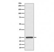 Western blot testing of human serum lysate with Kappa antibody. Expected molecular weight: 23-25 kDa.