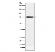 Western blot testing of human plasma lysate with Human IgM antibody. Expected molecular weight: 70-75 kDa.