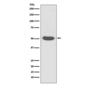 Western blot testing of human A431 cell lysate with Cytokeratin 14 antibody. Predicted molecular weight ~53 kDa.