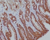 IHC staining of FFPE human stomach tissue with KRT14 antibody. HIER: boil tissue sections in pH6, 10mM citrate buffer, for 10-20 min and allow to cool before testing.