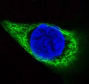 IF/ICC staining of human HACAT cells with KRT14 antibody (green) and DAPI nuclear stain (blue).