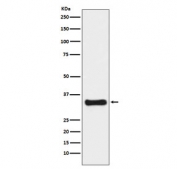 Western blot testing of human HeLa cell lysate with Thymidylate Synthase antibody. Predicted molecular weight ~36 kDa.
