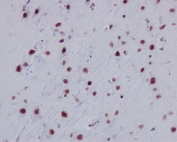 IHC staining of FFPE mouse brain tissue with acetyl-Histone H2A Antibody (Lys9). HIER: boil tissue sections in pH6, 10mM citrate buffer, for 10-20 min and allow to cool before testing.