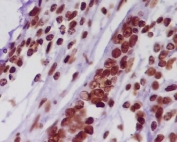 IHC staining of FFPE human colon tissue with Histone H2A antibody. HIER: boil tissue sections in pH6, 10mM citrate buffer, for 10-20 min and allow to cool before testing.