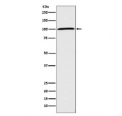 Western blot testing of human HeLa cell lysate with ATP1A1 antibody. Predicted molecular weight ~113 kDa.