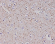 IHC staining of FFPE human brain tissue with APP antibody. HIER: boil tissue sections in pH6, 10mM citrate buffer, for 10-20 min and allow to cool before testing.