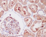 IHC staining of FFPE human kidney tissue with ARG1 antibody. HIER: boil tissue sections in pH6, 10mM citrate buffer, for 10-20 min and allow to cool before testing.