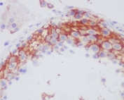 IHC staining of FFPE human testis tissue with ITGB3 antibody. HIER: boil tissue sections in pH6, 10mM citrate buffer, for 10-20 min and allow to cool before testing.