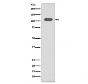 Western blot testing of human spleen lysate with ITGB3 antibody. Expected molecular weight: 87-110 kDa depending on glycosylation level.