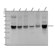 Application of PAI-1 / SERPINE1 antibody in western blot. Western blot analysis of PAI-1 / SERPINE1 antibody (clone ABHG-19) was performed using human U251, A549, U2OS, HepG2, A431, and U-87MG whole cell lysates. A prominent immunoreactive band is observed at approximately 45 kDa across multiple lanes, consistent with the predicted molecular weight of Plasminogen activator inhibitor 1. Stronger expression is evident in U251 and U-87MG lysates, with moderate signal in A549, U2OS, HepG2, and A431 cells, reflecting expected cell-type-dependent SERPINE1 expression. The detected band aligns with the predicted molecular weight of approximately 45 kDa under reducing conditions. PAI-1 is a secreted serpin that can exist in active and latent conformations, and minor intensity variation between lanes may reflect differences in expression levels and secretion dynamics rather than size heterogeneity. The blot demonstrates specific detection of endogenous PAI-1 at its predicted molecular weight in human cell lysates.