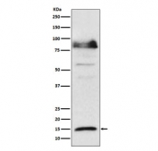 Western blot testing of lysate from HeLa cells treated with IFN alpha, with ISG15 antibody. Expected molecular weight: 15-17 kDa.