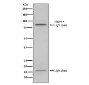Western blot testing of human HL60 cell lysate with MPO antibody. Expected molecular weight: 75-90 kDa (pro form), 150+ kDa (glycosylated mature form).