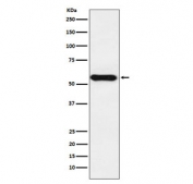 Western blot testing with Cytochrome P450 1A2 antibody. Predicted molecular weight ~58 kDa.