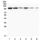 Western blot testing of 1) rat testis, 2) rat thymus, 3) rat spleen, 4) rat lung, 5) mouse testis and 6) mouse thymus lysate with Plasminogen antibody. Predicted molecular weight ~92 kDa, may be observed at higher molecular weights due to glycosylation.