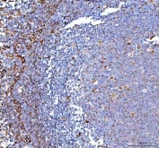 IHC staining of FFPE human tonsil tissue with PPA2 antibody. HIER: boil tissue sections in pH8 EDTA for 20 min and allow to cool before testing.