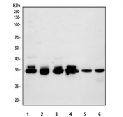 Western blot testing of 1) human 293T, 2) human U-87 MG, 3) human HepG2, 4) human MCF7, 5) mouse heart and 6) mouse kidney tissue lysate with PPA2 antibody. Predicted molecular weight: 35-40 kDa (multiple isoforms).