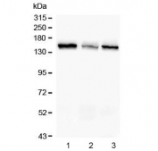 Western blot testing of mouse 1) thymus, 2) kidney and 3) HEPA1-6 lysate with RAB3GAP2 antibody. Predicted molecular weight ~156 kDa.