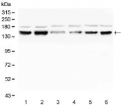Western blot testing of human 1) K562, 2) HL60, 3) ThP-1, 4) Raji, 5) HeLa and 6) HepG2 cell lysate with RAB3GAP2 antibody. Predicted molecular weight ~156 kDa.