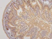 IHC staining of FFPE rat intestine with RAB3GAP2 antibody. HIER: boil tissue sections in pH6, 10mM citrate buffer, for 20 min and allow to cool before testing.
