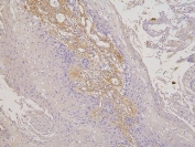 IHC staining of FFPE human esophagus squama tissue with RBMS3 antibody. HIER: boil tissue sections in pH6, 10mM citrate buffer, for 20 min and allow to cool before testing.