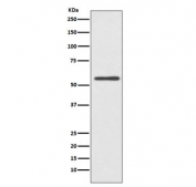 Western blot testing of human HeLa cell lysate with Cytochrome P450 2E1 antibody. Predicted molecular weight ~57 kDa.