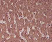 IHC staining of FFPE human liver tissue with ALPL antibody. HIER: boil tissue sections in pH6, 10mM citrate buffer, for 10-20 min and allow to cool before testing.
