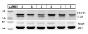 EIF2S1 Antibody Tissue WB. Western blot analysis of porcine intestinal tissue lysates using EIF2S1 antibody detecting eIF2 alpha. Lanes represent different segments of large and small intestine. A band is detected at approximately 36 kDa, consistent with the predicted molecular weight of EIF2S1. Actin is shown as a loading control.