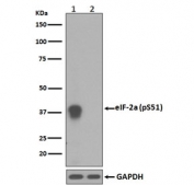 Western blot testing of lysate from human HeLa cells 1) treated with Calyculin A and 2) untreated, with phospho-EIF2S1 antibody (pS51). Predicted molecular weight ~36 kDa.
