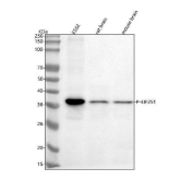 EIF2S1 Antibody Multi-Species WB. Western blot analysis of human and rodent samples using EIF2S1 antibody detecting eIF2 alpha. Lane 1: human K562 whole cell lysate, Lane 2: rat brain tissue lysate, Lane 3: mouse brain tissue lysate. A band is detected at approximately 36 kDa in all samples, consistent with the predicted molecular weight of EIF2S1. Signal intensity is strongest in K562 cells, with lower but detectable expression in brain tissues, consistent with ubiquitous expression of this translation initiation factor across species.