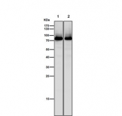 Western blot testing of 1) mouse brain and 2) rat brain tissue lysate with PKC beta 2 antibody. Predicted molecular weight ~77 kDa.