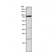 Western blot testing of human K562 cell lysate with PKC beta 2 antibody. Predicted molecular weight ~77 kDa.