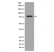Western blot testing of human K562 cell lysate with PKC beta 2 antibody. Predicted molecular weight ~77 kDa.